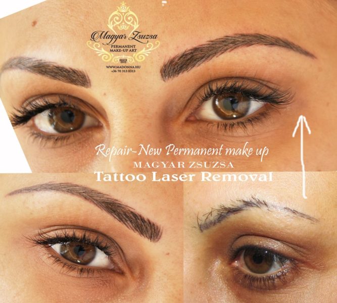 magyar_zsuzsa_szemoldok_sminktetovalas_javitas