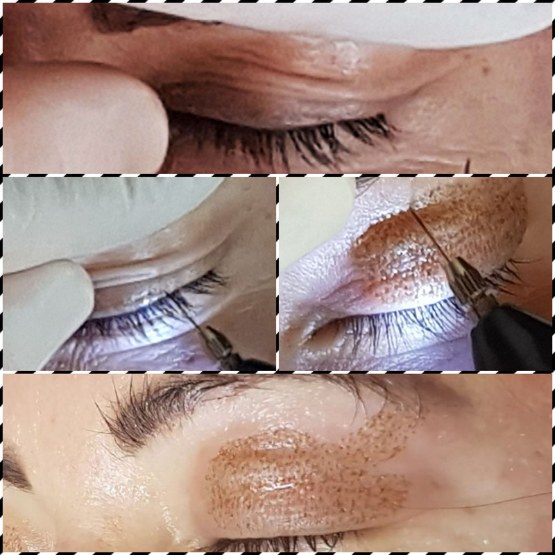 magyar_zsuzsa_budapest_ranctalanitas_philings_2017_10 (7)