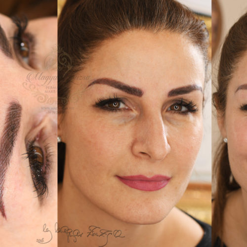 magyarzsuzsapmuart_tattoo_removal3 magyarzsuzsapmuart_tattoo_removal3